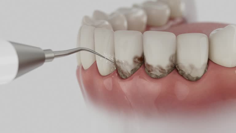 Reliable Root Canal Treatment contractor in Chowan County County, NC by Dentist Open Now